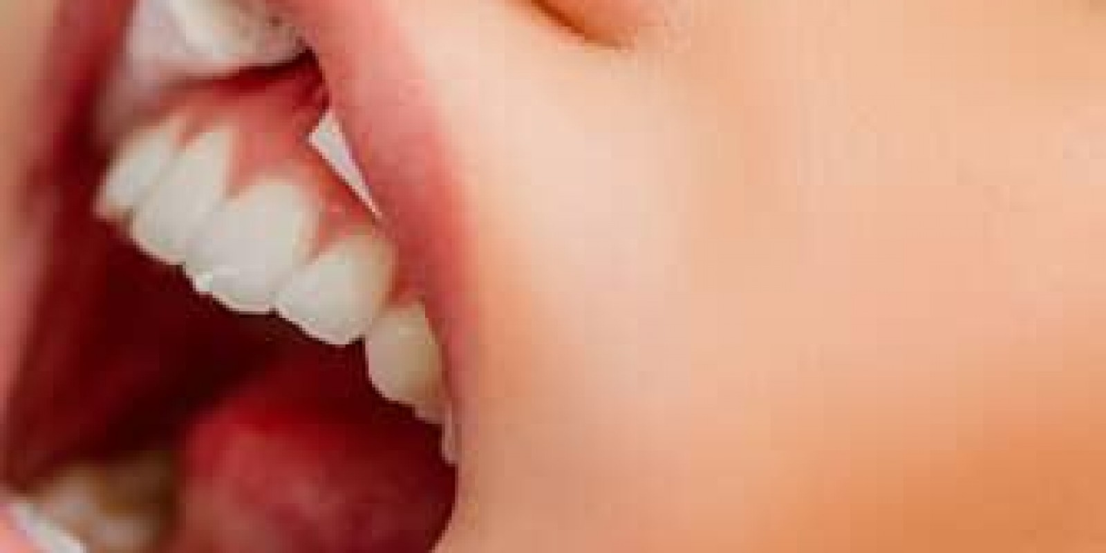 Antes do Periodontia